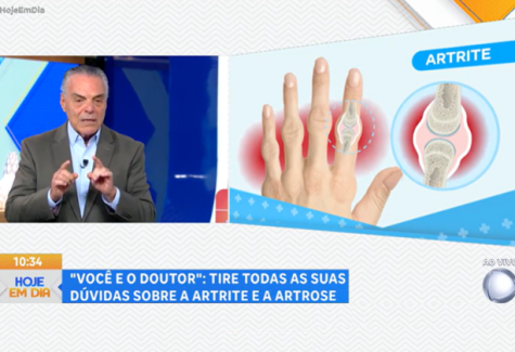 Como prevenir a artrite e a artrose
