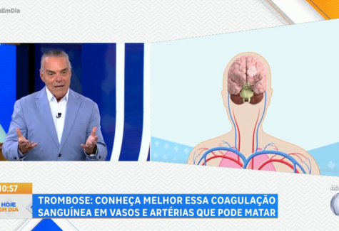 Cuidado com a trombose 