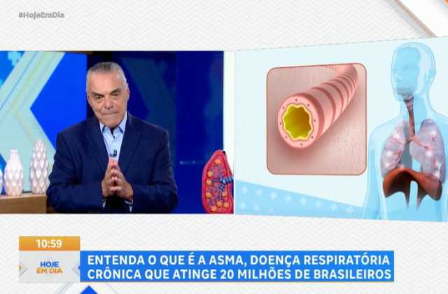 Asma atinge 20 milhões de brasileiros